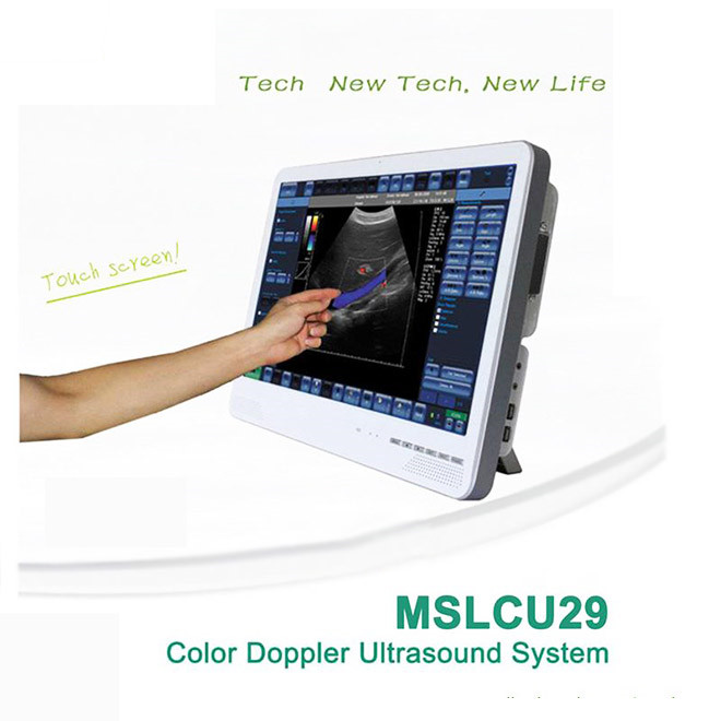 Newest touch screen laptop ultrasound machine AMCU29