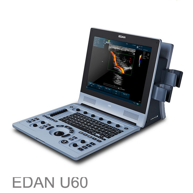 Kostoja e sistemit të ultrazërit diagnostikues Edan U60
