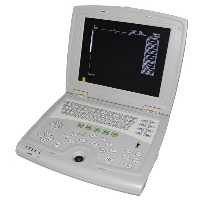 Full digital B mòd ultrasond eskanè machin AMDU07 pou vann