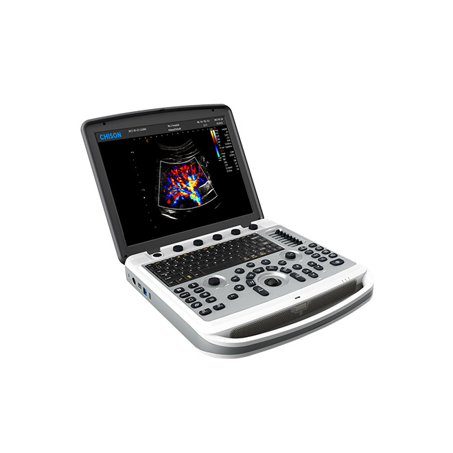 מכשיר אולטרסאונד מדויק של Chison SonoBook8 Vet