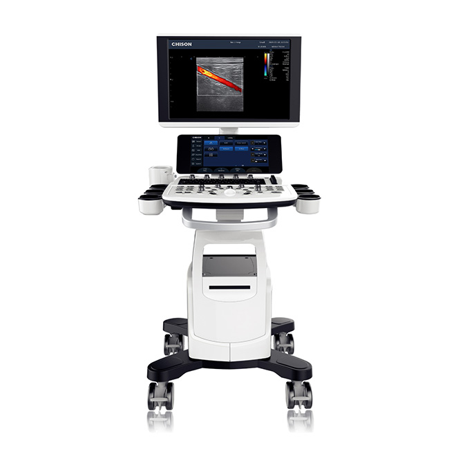Ang nangunguna sa industriya na disenyo ng ultrasound machine Chison CBit6