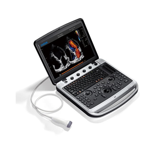 Premium vermoë ultraklank masjien Chison SonoBook9