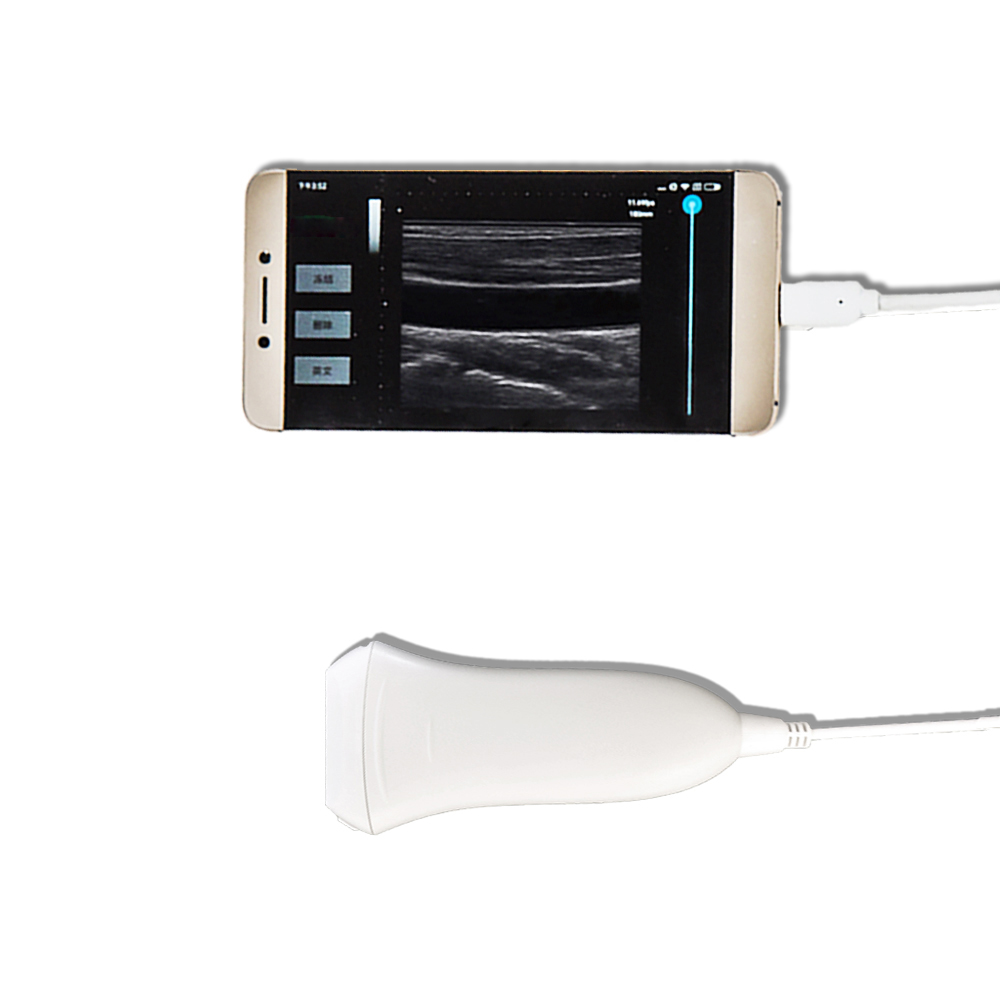 Ultrazvuk na lineárnu diagnostiku Amain MagiQ 2L