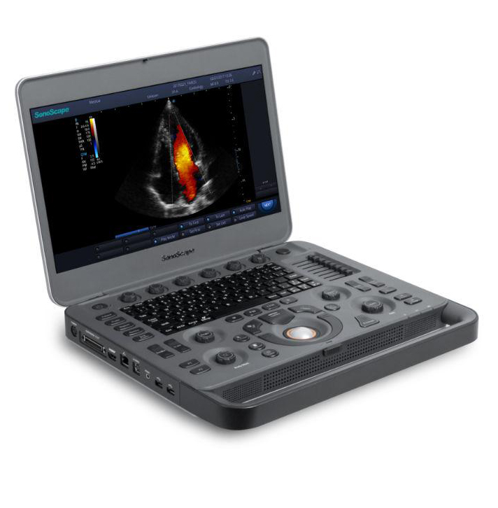 SonoScape X5 Esnek Pilli Elde Taşınabilir Ultrason İnce Ergonomik Tasarım Ultrason Teşhis Sistemi