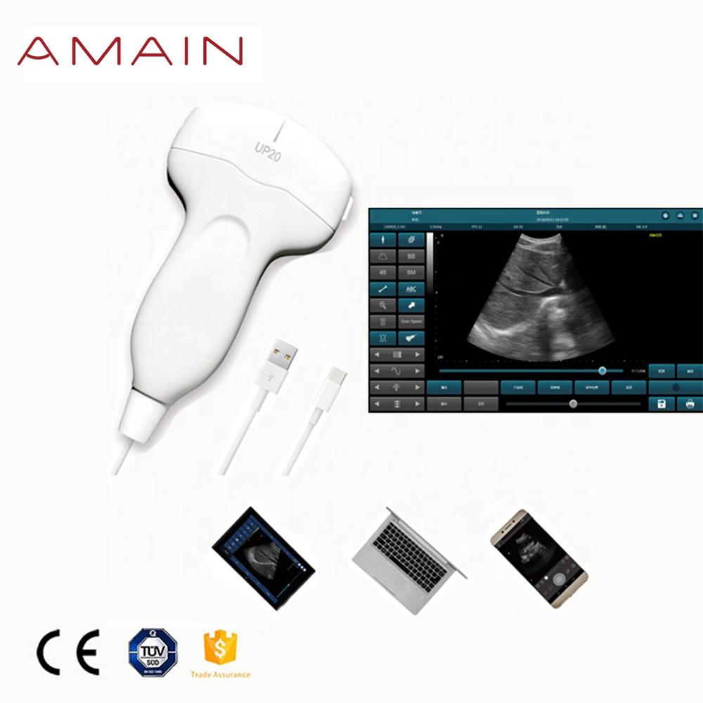 Amain MagiQ 2 Конвексен рачен медицински USB ултразвук