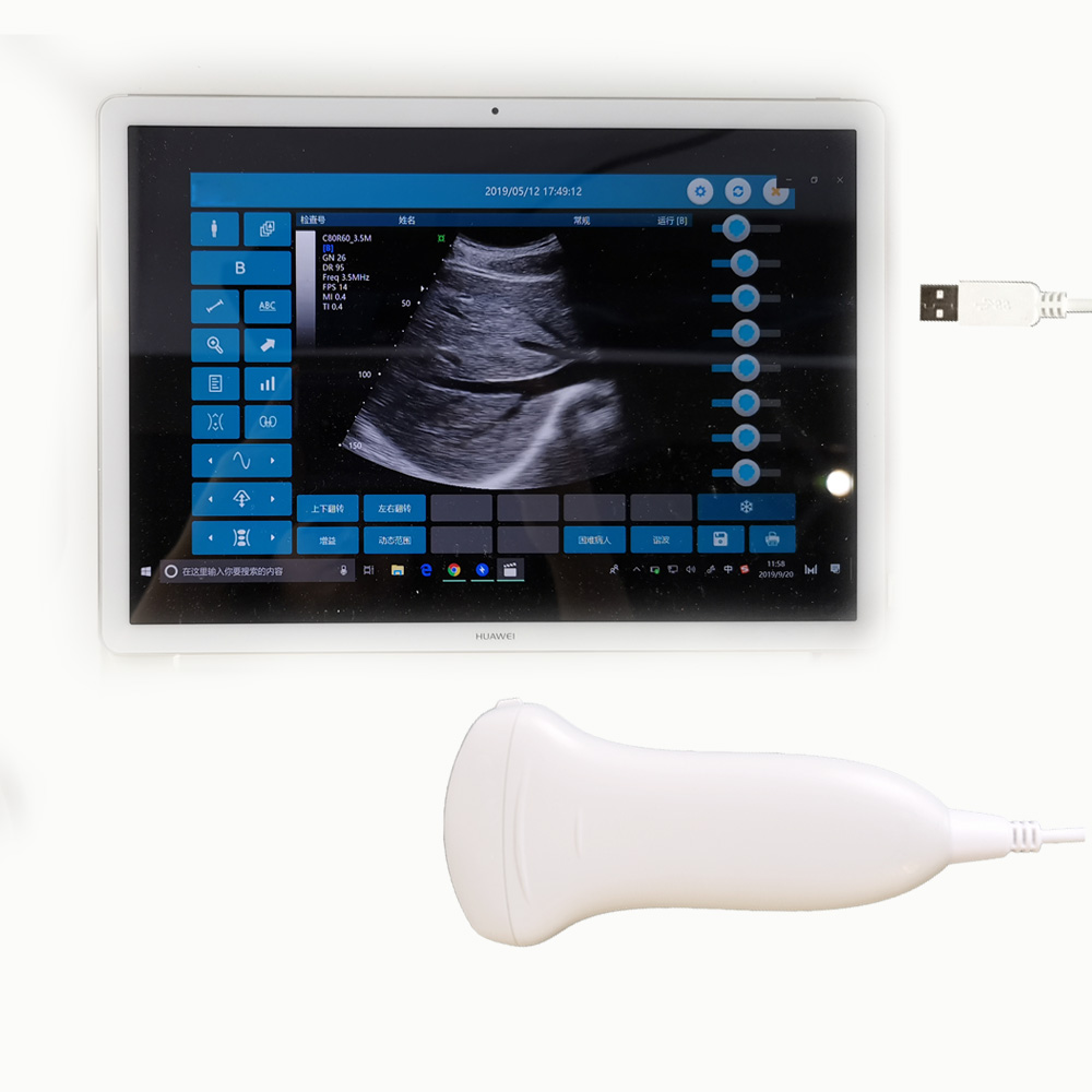 Amain MagiQ 2C HD Convex Handheld échographe à domicile grossesse