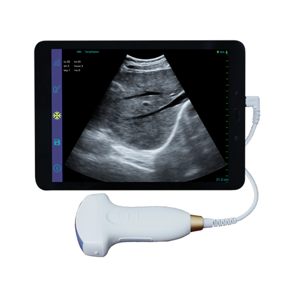 Amain MagiQ MPUC5-2E C/B Ručni medicinski ultrazvuk