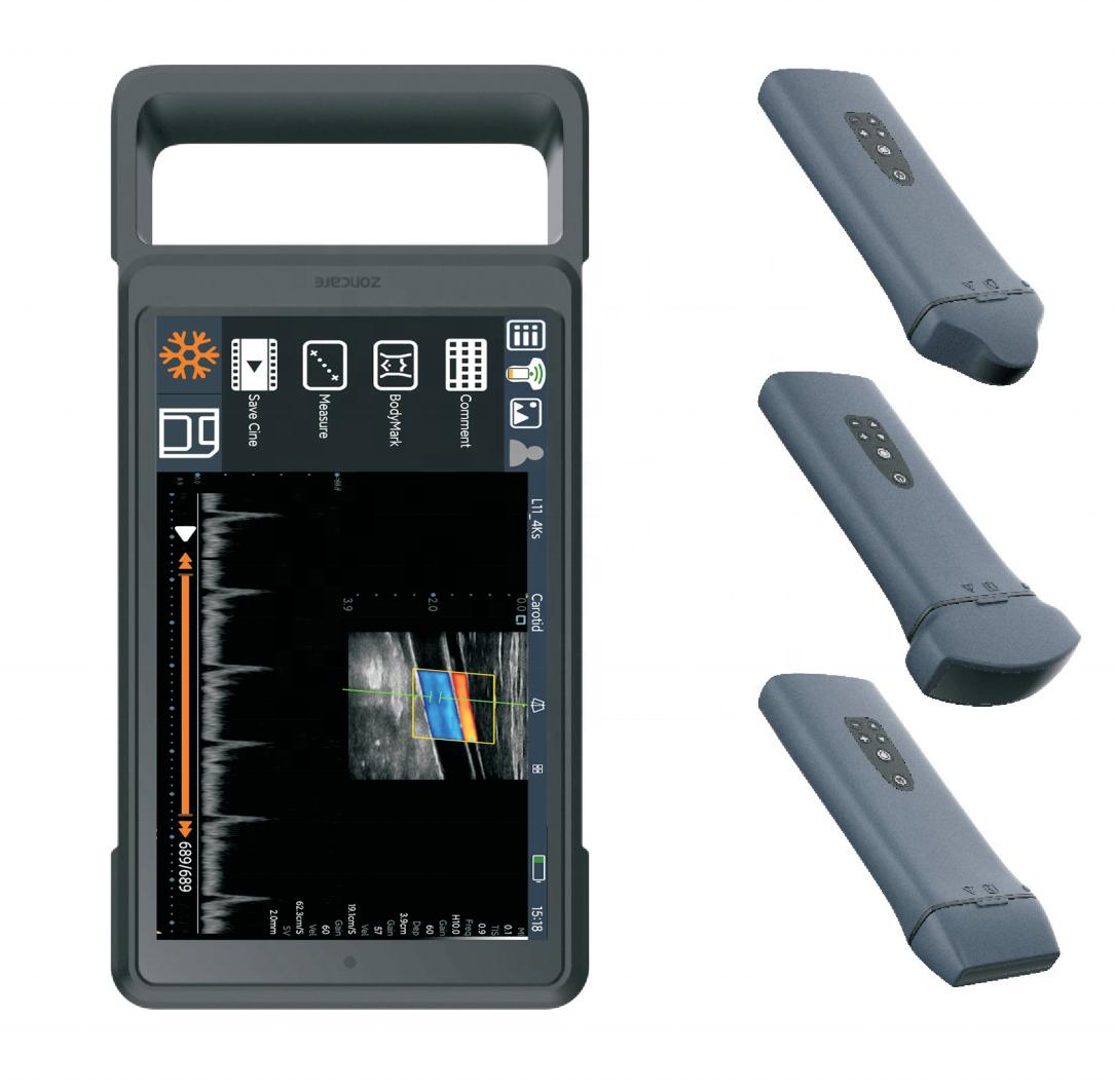 ລາຄາໂຮງງານຂອງ zoncare mini handheld ultrasound ເຄື່ອງ IMACSONIC ກັບ probe convex ແລະ standby 6 ຊົ່ວໂມງຍາວ