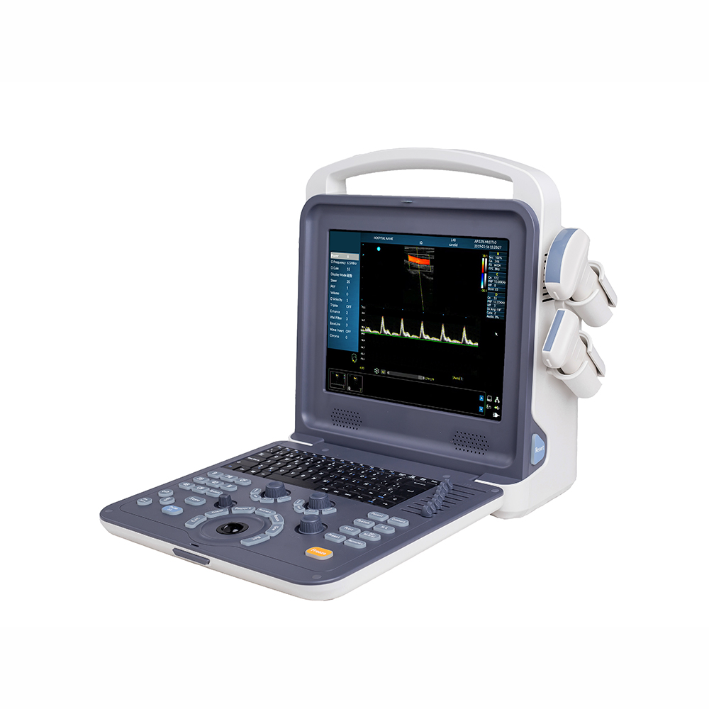 AMAIN Chọta C0 Diagonostic Ultrasound ngwá ọrụ