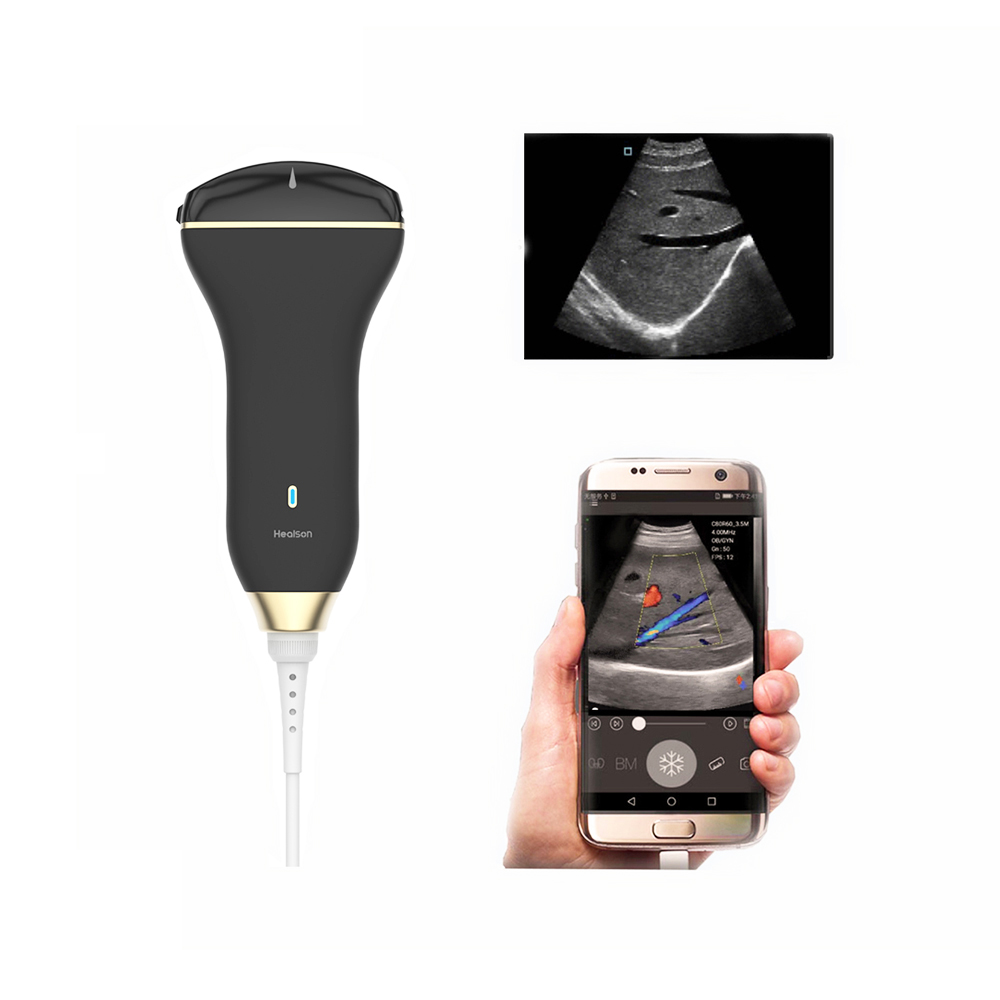 Amain MagiQ 3C fetis koulè Doppler ultrason machin