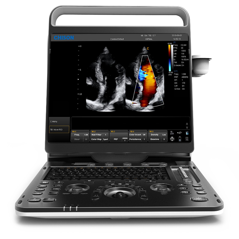 Chison EBIT 60/60v 4D/5D ultrazvučni sustav za snimanje fetusa u stvarnom vremenu i dijagnoza srca sa svestranim paketom mjerenja
