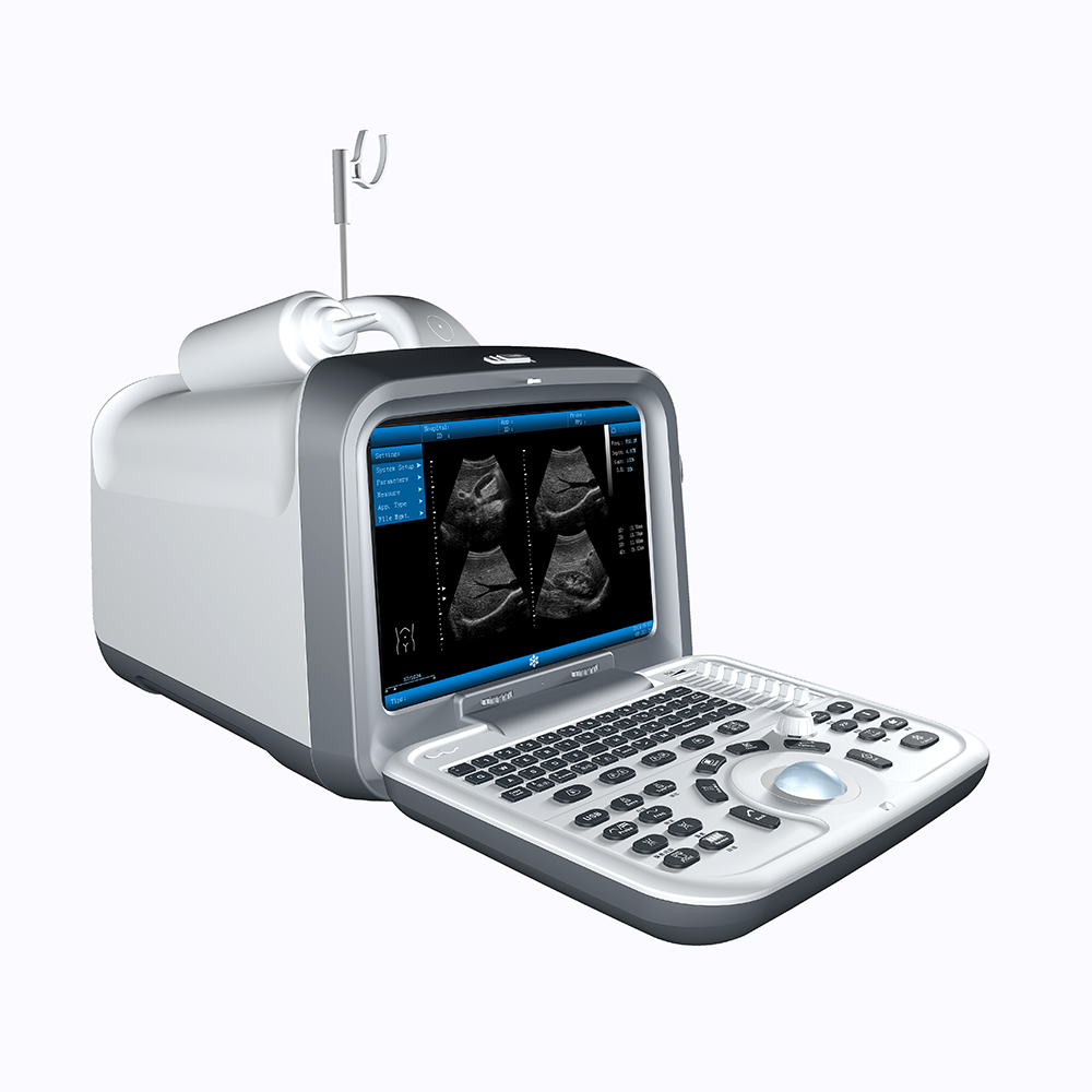 ZONCARE ZQ-6022 Medyske echografie-ynstruminten Draachbere ultrasoundmasine-scansysteem foar sikehûsgebrûk