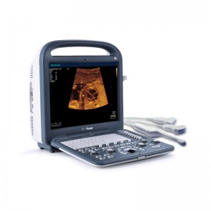I-SonoScape S2 Vet Sebenzisa i-Medical Ultrasound Equipment