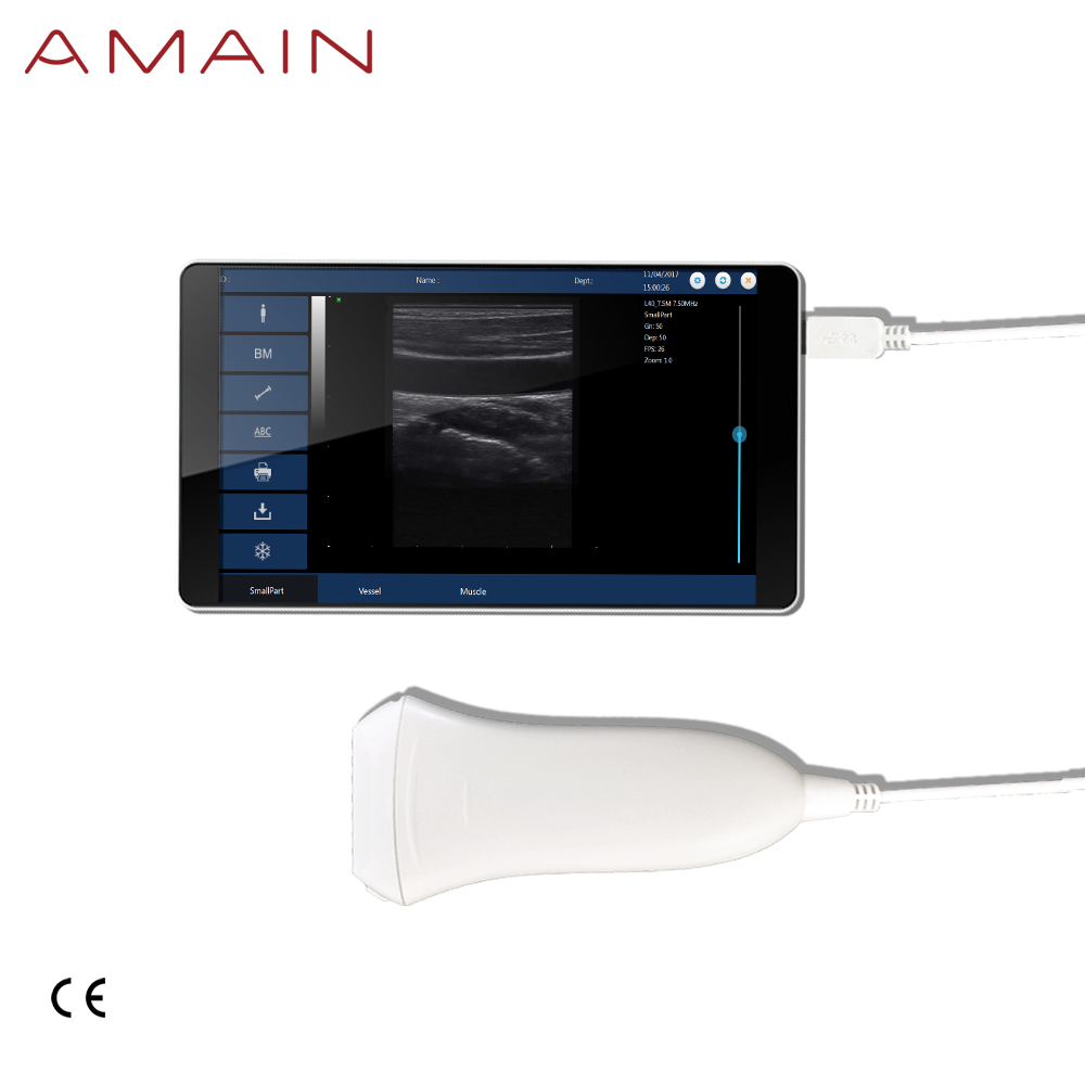 Ультразвуковое оборудование для быстрой диагностики Amain MagiQ 2L