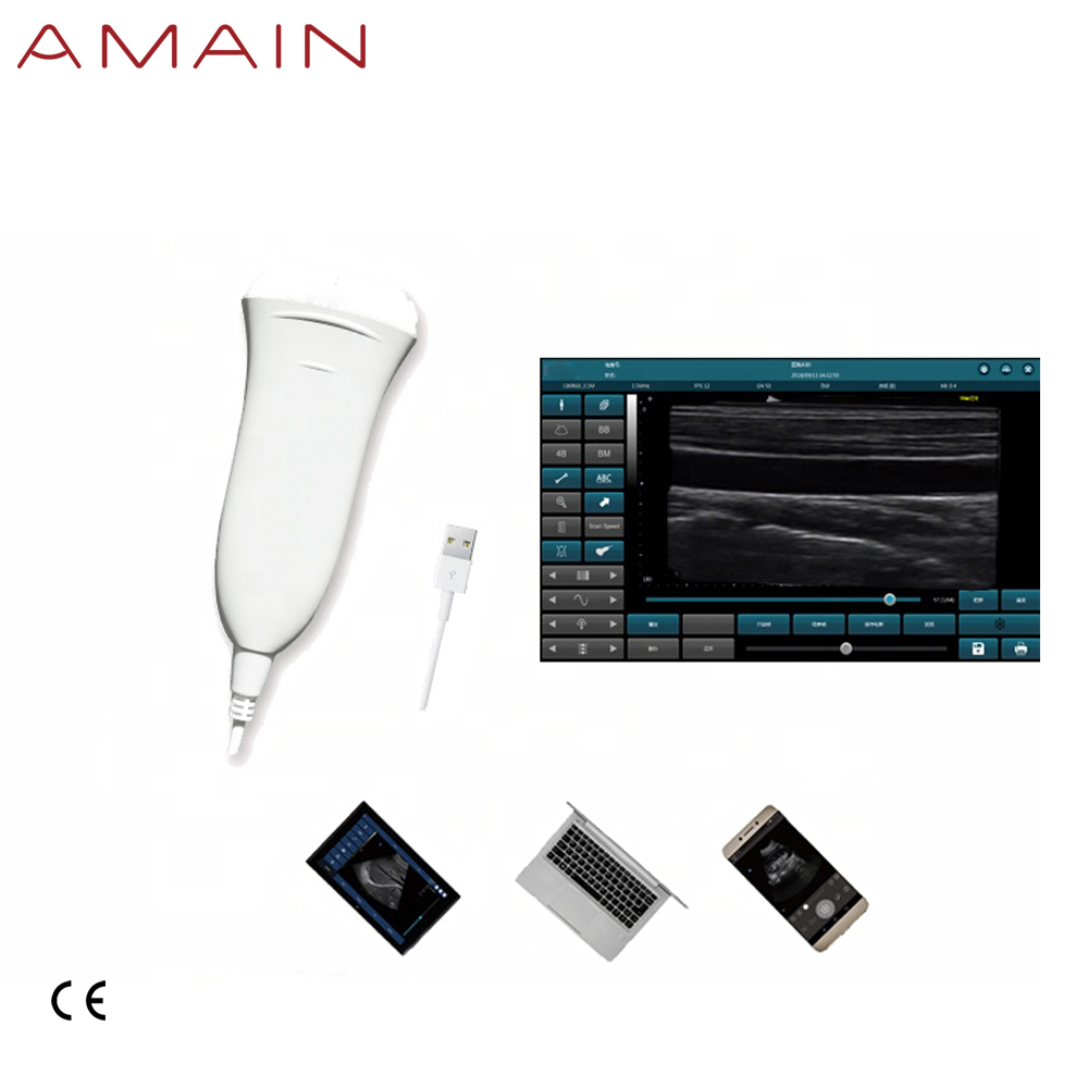 Amain MagiQ 2L HD linearni prijenosni USB ultrazvučni aparat za terapiju
