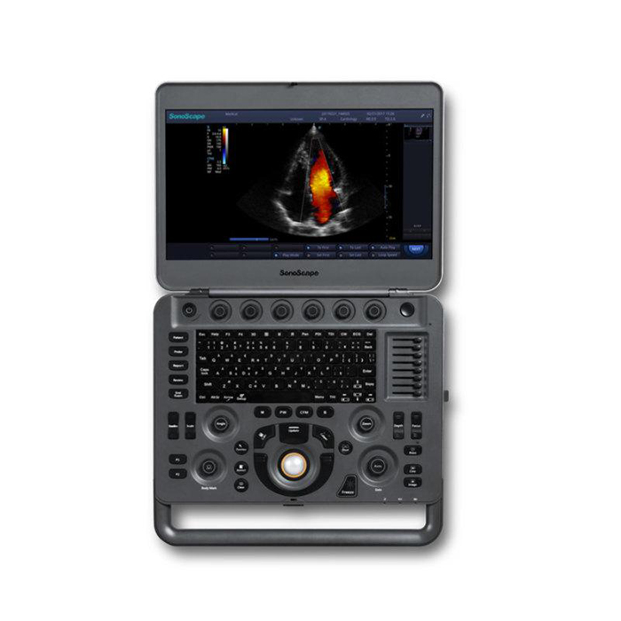 SonoScape X3 Yüksek Kaliteli Görüntü Hafif Dizüstü Bilgisayar Renkli Doppler Ultrason Sistemi Hastane Teşhisi için Satışta