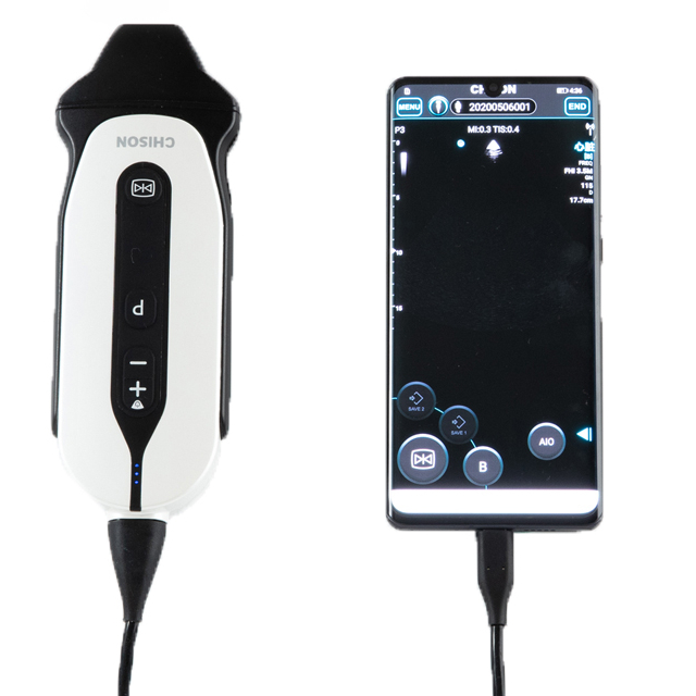 Chison SonoEye P3 mobilā diagnostikas fāzu masīva ultraskaņa